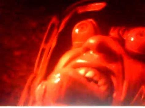 total recall eye bulge|Total Recall's Bulging Eyes Scene Is Scientifically Accurate.